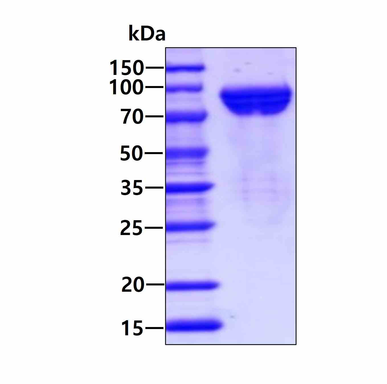 3 μg by SDS-PAGE under reducing condition and visualized by coomassie blue stain.